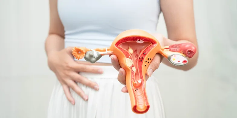bilateral polycystic ovaries symptoms​