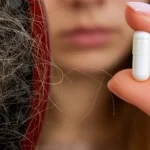 pcos hair loss treatment​