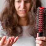 PCOS Hair Loss